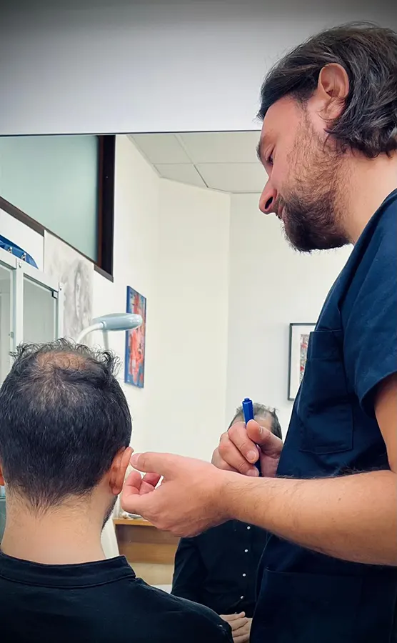 Trapianto capelli in Italia. Visita preliminare, intervento eseguito dal Dottor Mattia Benedetti.